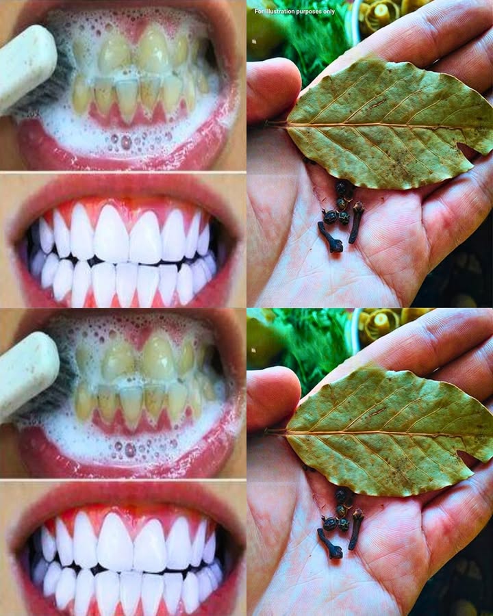Sbiancare i denti facilmente