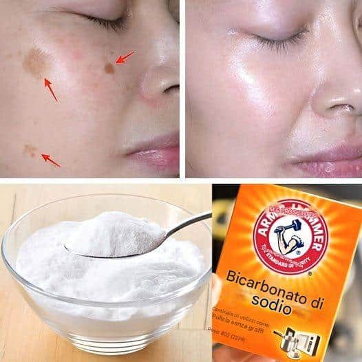 bicarbonato di sodio viso