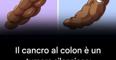 cancro al colon segnali