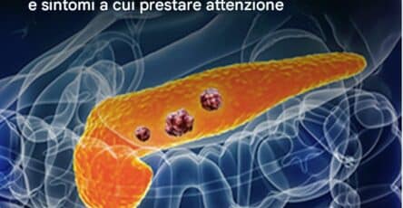 cancro al pancreas segnali