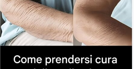 cura della pelle invecchiata