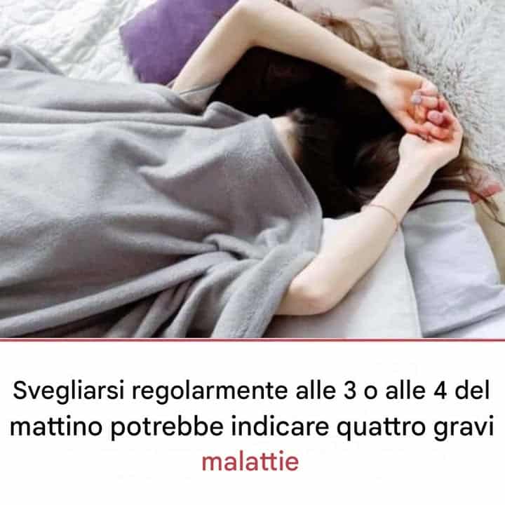irregolarità del sonno