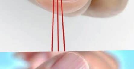 linee verticali sulle unghie