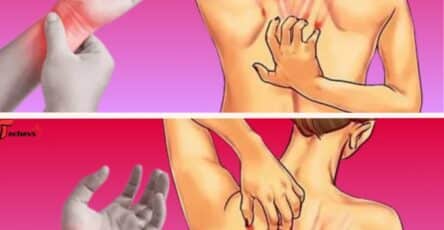 lupus sintomi da conoscere