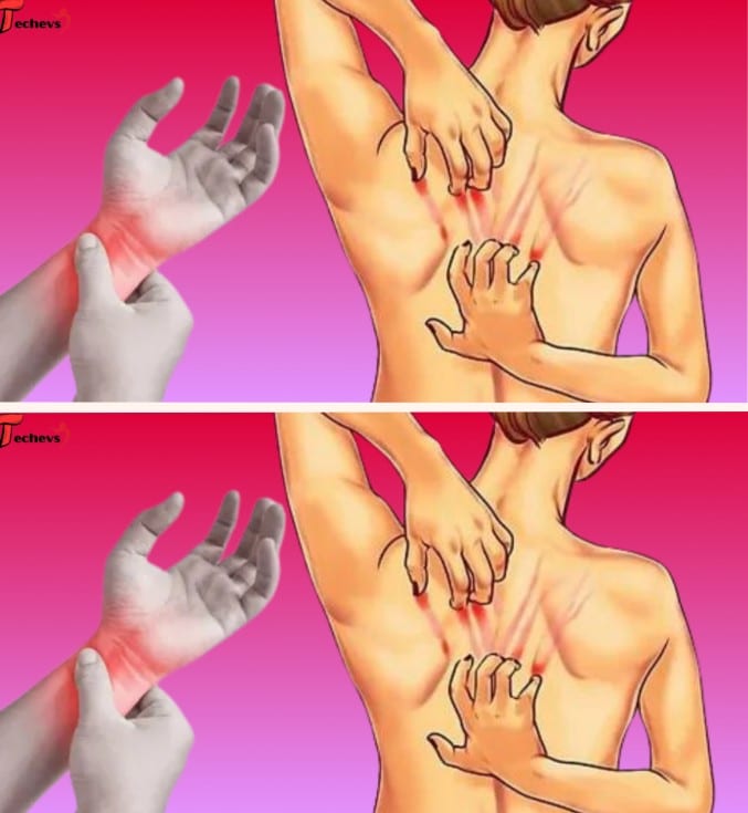 lupus sintomi da conoscere
