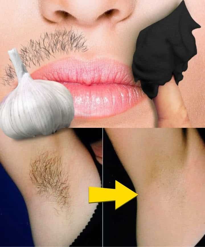 metodi naturali peli corpo