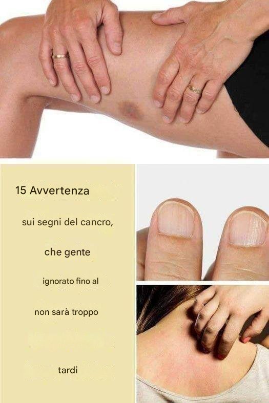 segnali allarmanti cancro