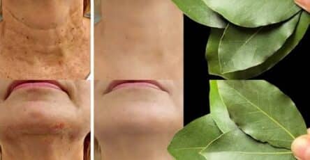 Antirughe naturale all'alloro