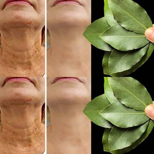 Antirughe naturale all'alloro