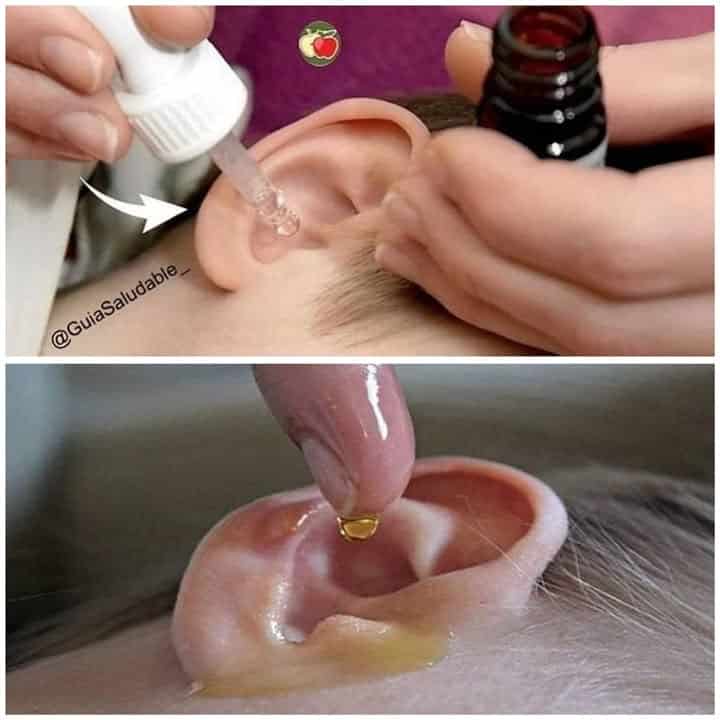 Recupero udito naturale