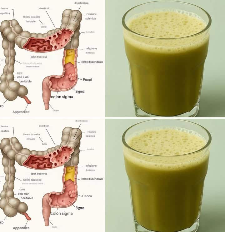Succo naturale detossificante