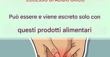 cibi abbassare acido urico