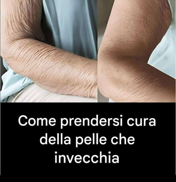 cura pelle invecchia