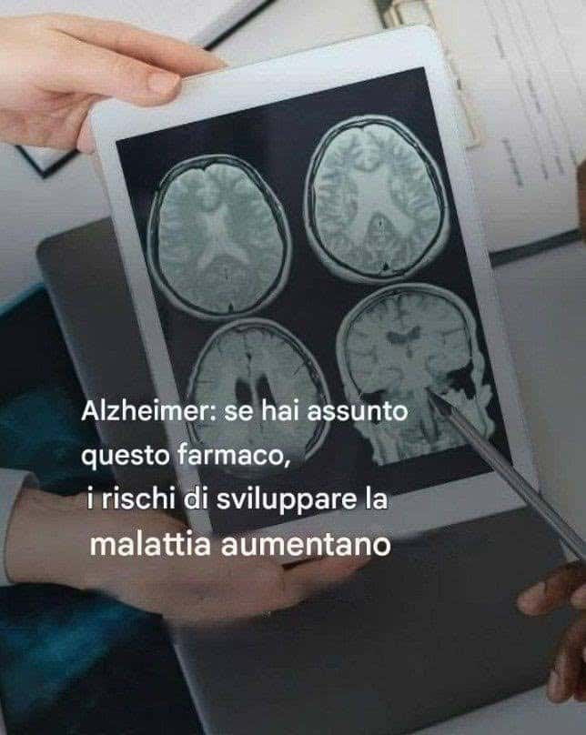farmaco legame all'Alzheimer
