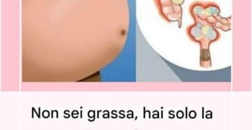 pancia gonfia rimedi naturali