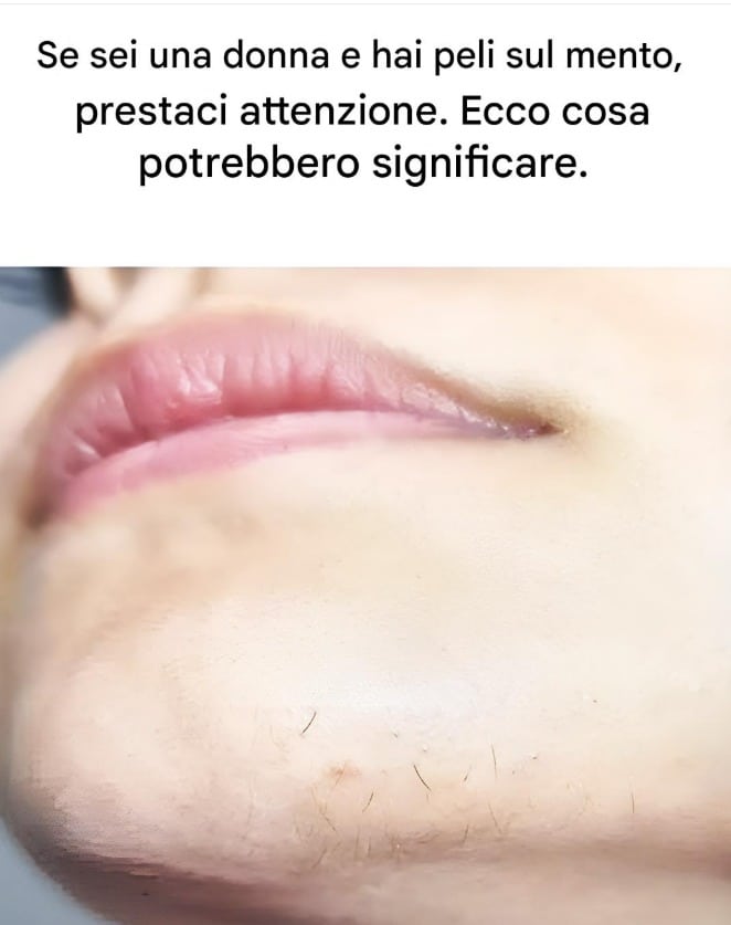 parlare dei peli mento