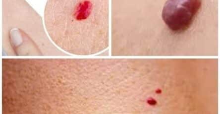 punti rossi pelle significato