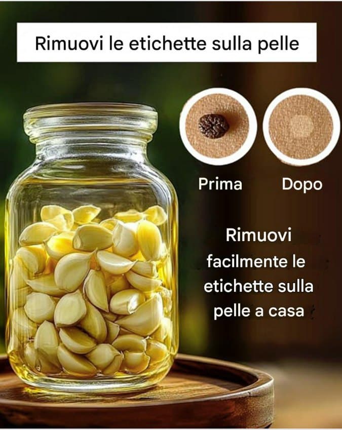 rimedi casalinghi escrescenze cutanee