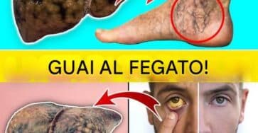 segnali fegato difficoltà