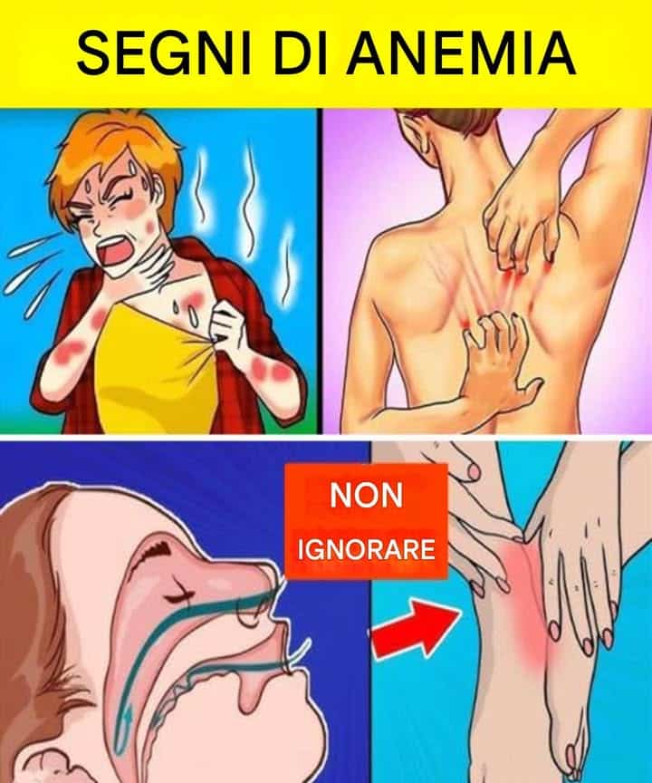 segnali sintomi diabete precoci